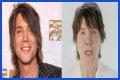 John Rzeznik Facelift | Goo Goo Dolls Frontman Plastic Surgery Before And After